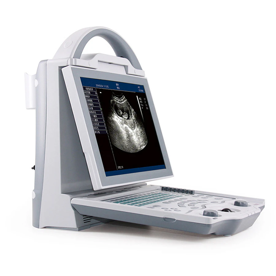 ASP-100AB Ophthalmic A and B Scan Machine