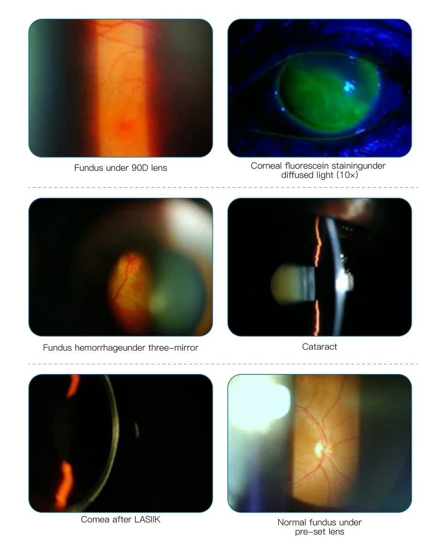 SL-520 Digital Slit Lamp structure image