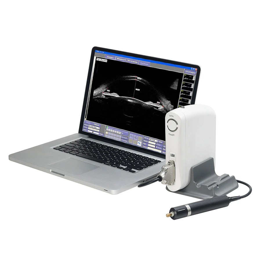 SW-2100 Ophthalmic AB Scan Machine