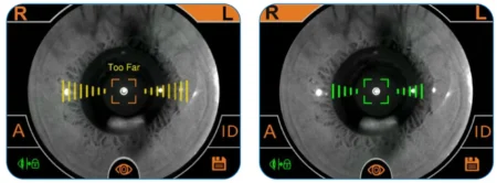 Auto alignment Auto focus