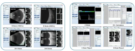 Ophthalmic AB Scan Machine