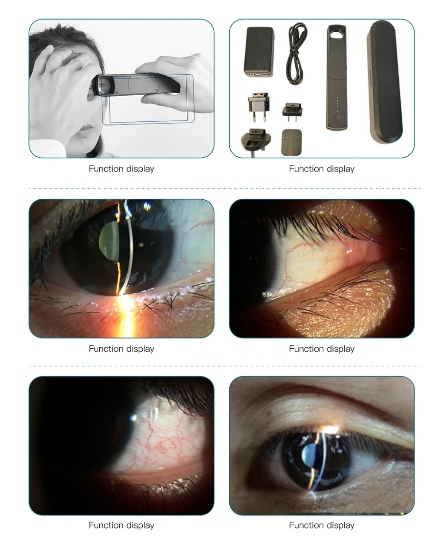 S150 functional illustration image
