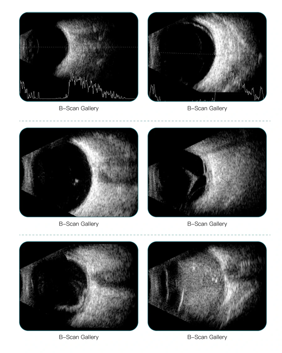 LK-3000AB Imaging image