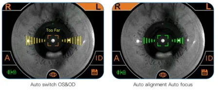 Auto alignment Auto focus