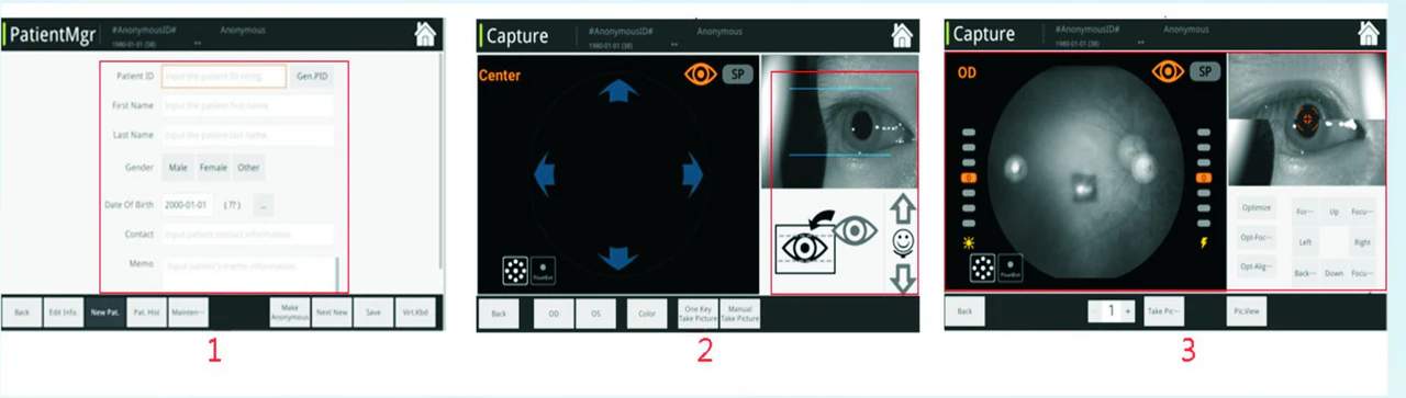 Reticam 3100 partial image