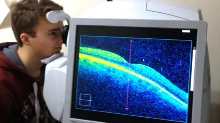 OCT machines test imaging