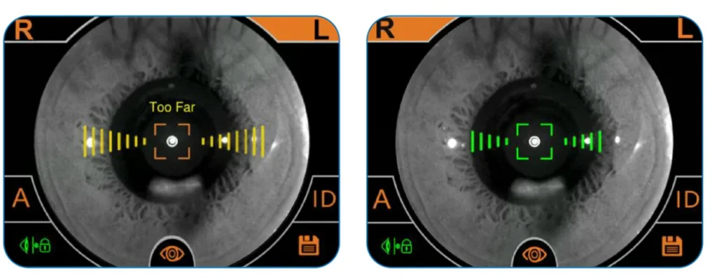 Intraocular Pressure Measurement Demonstration