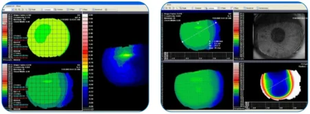 Placido instruments analyze rings reflected from the tear film