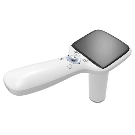 handheld fundus camera handheld fundus camera