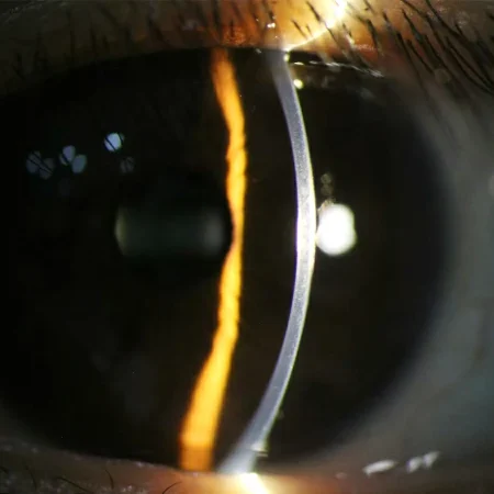 SL-520C imaging image SL-520C imaging image