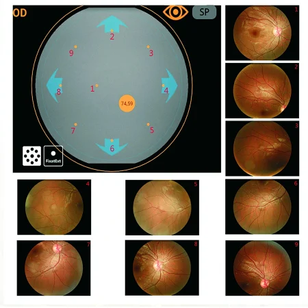 9-position mosaic 9-position mosaic
