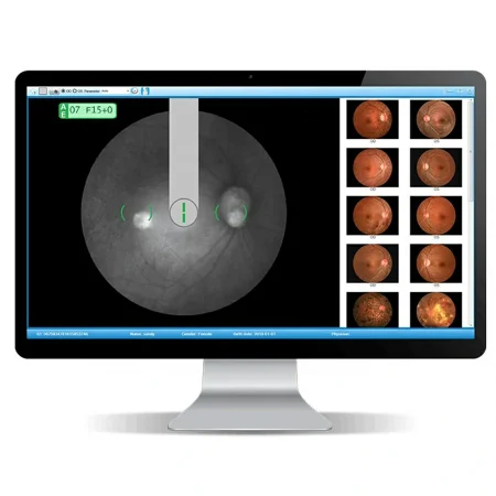 Digital Fundus Camera with FFA Digital Fundus Camera with FFA