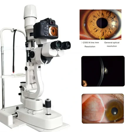 SL-520 Digital Slit Lamp application demonstration image SL-520 Digital Slit Lamp application demonstration image