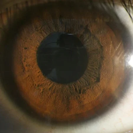 SL-520C imaging image SL-520C imaging image