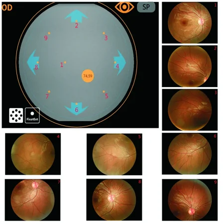 135°wide field 9 position mosaic device