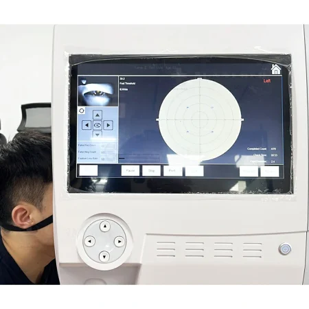 Early Detection of Subtle Visual Defects Early Detection of Subtle Visual Defects
